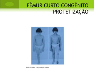 FASE REPARATIVA
                                          “CALO DURO”




PROF. VAGNER SÁ - SAVAGNER@IG.COM.BR
 