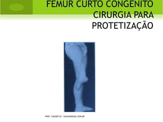 FASE REMODELAGEM




PROF. VAGNER SÁ - SAVAGNER@IG.COM.BR
 