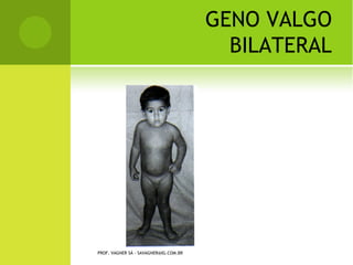 Q UANTO                         AO CONTATO COM
                                           O MEIO EXTERNO

   Fechada: não há contato.
   Aberta: há contato.




    PROF. VAGNER SÁ - SAVAGNER@IG.COM.BR
 