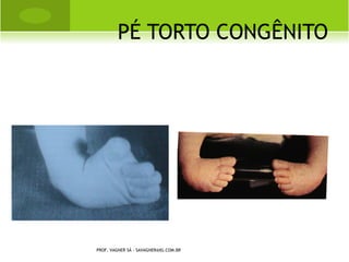 Q UANTO          À DIREÇÃO DO TRAÇO DE
                                            FRATURA




     PROF. VAGNER SÁ - SAVAGNER@IG.COM.BR
 