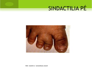 PROF. VAGNER SÁ - SAVAGNER@IG.COM.BR
 