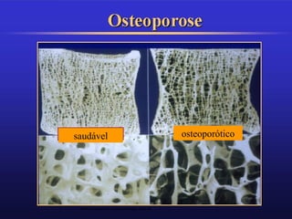 T RANSTROCANTÉRICA    E
                                       ACETÁBULO




PROF. VAGNER SÁ - SAVAGNER@IG.COM.BR
 