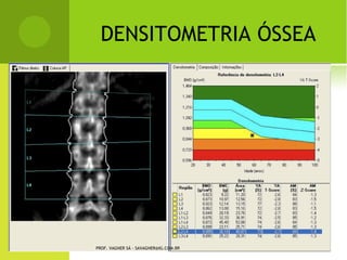 SUBTROCANTÉRICA




PROF. VAGNER SÁ - SAVAGNER@IG.COM.BR
 