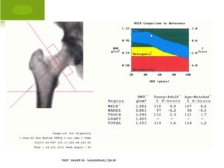 DIÁFISE




PROF. VAGNER SÁ - SAVAGNER@IG.COM.BR
 