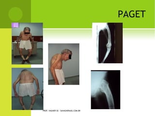 PROF. VAGNER SÁ - SAVAGNER@IG.COM.BR
 