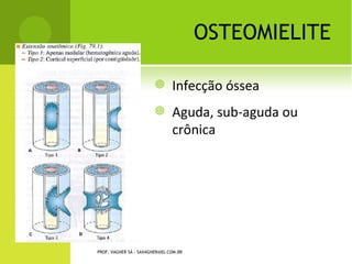 PROF. VAGNER SÁ - SAVAGNER@IG.COM.BR
 