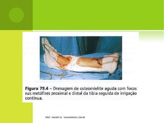 PROF. VAGNER SÁ - SAVAGNER@IG.COM.BR
 