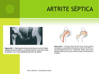 PROF. VAGNER SÁ - SAVAGNER@IG.COM.BR
 
