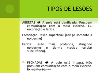 TIPOS DE LESÕES

ABERTAS  A pele está danificada. Possuem
   comunicação com o meio externo. Ex.
   escoriação e ferida.
Escoriação: lesão superficial (atinge somente a
   epiderme)
Ferida: lesão mais profunda, atingindo epiderme
   e derme (tecido celular subcutâneo).


   FECHADAS  A pele está integra. Não
    possuem comunicação com o meio externo.
    Ex. contusão.
    PROF. VAGNER SÁ - SAVAGNER@IG.COM.BR
 