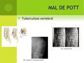P SEUDO - ARTROSE PATELA




PROF. VAGNER SÁ - SAVAGNER@IG.COM.BR
 