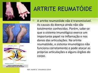 PATELECTOMIA




PROF. VAGNER SÁ - SAVAGNER@IG.COM.BR
 