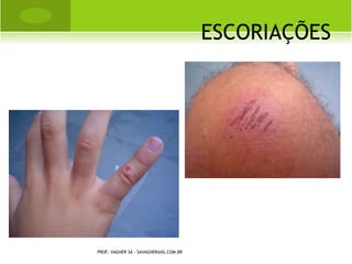 E SCORIAÇÕES




PROF. VAGNER SÁ - SAVAGNER@IG.COM.BR
 