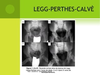 PROF. VAGNER SÁ - SAVAGNER@IG.COM.BR
 