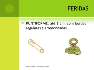 FERIDAS

   PUNTIFORME: até 1 cm, com bordas
    regulares e arredondadas.




    PROF. VAGNER SÁ - SAVAGNER@IG.COM.BR
 