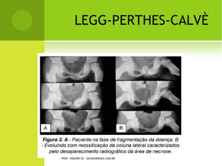 PROF. VAGNER SÁ - SAVAGNER@IG.COM.BR
 
