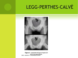 PROF. VAGNER SÁ - SAVAGNER@IG.COM.BR
 