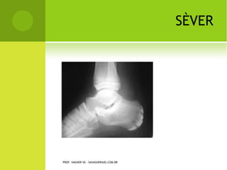 PROF. VAGNER SÁ - SAVAGNER@IG.COM.BR
 