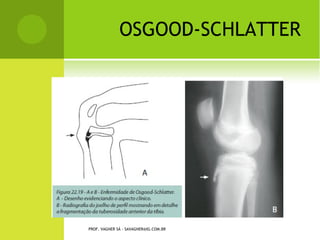 PROF. VAGNER SÁ - SAVAGNER@IG.COM.BR
 