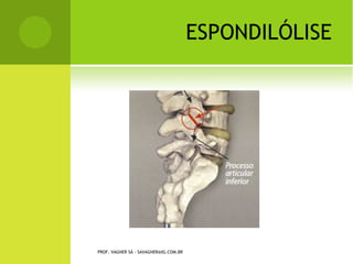 PROF. VAGNER SÁ - SAVAGNER@IG.COM.BR
 