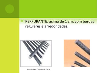    PERFURANTE: acima de 1 cm, com bordas
    regulares e arredondadas.




    PROF. VAGNER SÁ - SAVAGNER@IG.COM.BR
 