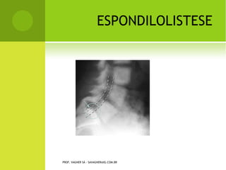 PROF. VAGNER SÁ - SAVAGNER@IG.COM.BR
 