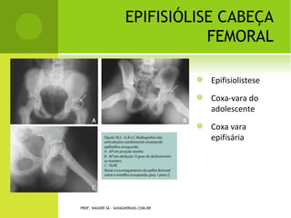 PROF. VAGNER SÁ - SAVAGNER@IG.COM.BR
 