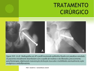 ESPORÃO




PROF. VAGNER SÁ - SAVAGNER@IG.COM.BR
 