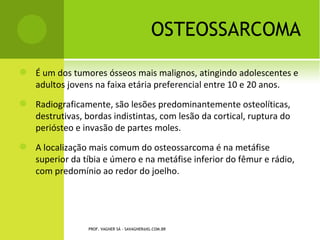 REFERÊNCIAS

   Ruaro AF. Ortopedia e traumatologia: temas fundamentais e reabilitação.
    Ed. Elenco, Umuarama – Paraná, 2004.

   Cohen M et al. Tratado de ortopedia. SBOT/ROCA, 2007.

   GREENER, W. NETTER. Ortopedia. 1ª ed - Rio de Janeiro: Elsevier, 2006.

   HEBERT, S. Ortopedia e Traumatologia: princípios e prática. 4ª ed - Porto
    Alegre: Artmed, 2009.

   NETTER, FRANK H. Netter ortopedia. Rio de Janeiro: Elsevier: 2006.

   ROBBINS. Patologia Estrutural e Funcional. Rio de Janeiro: Guanabara
    Koogan, 2000.

   SALTER, R., B. Distúrbios e Lesões do Sistema Musculoesquelético. 3ª ed -
    Rio de Janeiro. Medsi, 2001.
                    PROF. VAGNER SÁ - SAVAGNER@IG.COM.BR
 