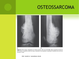 Slides disfuncoes musculoesqueleticas