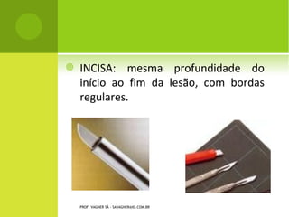    INCISA: mesma profundidade do
    início ao fim da lesão, com bordas
    regulares.




    PROF. VAGNER SÁ - SAVAGNER@IG.COM.BR
 