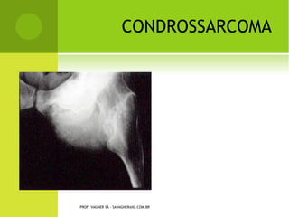 Slides disfuncoes musculoesqueleticas