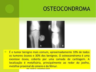 Slides disfuncoes musculoesqueleticas