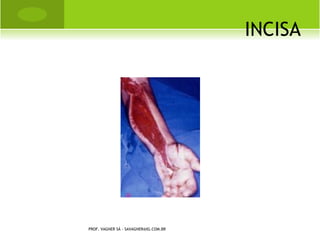 INCISA




PROF. VAGNER SÁ - SAVAGNER@IG.COM.BR
 