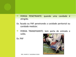 QUEIMADURAS




PROF. VAGNER SÁ - SAVAGNER@IG.COM.BR
 