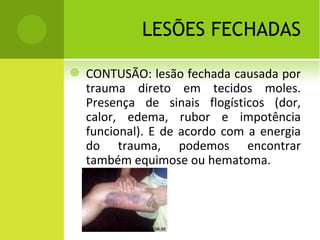 M ÁCULAS H EMORRÁGICAS
   Equimose: hemorragia de pequenos vasos,
    tendo como consequência o aparecimento de
    uma mácula (mancha) hemorrágica visível na
    pele.
   Hematoma: hemorragia com maior volume de
    sangue abaixo da pele, com o aparecimento de
    um abaulamento na mesma. Às vezes é
    necessário drenagem, pois pode se tornar meio
    de cultura de bactérias.
   Petéquias: Se a quantidade de sangue é muito
    pequena, mas as pequeninas manchas são em
    grande número costuma-se chamá-las de
    petéquias
    PROF. VAGNER SÁ - SAVAGNER@IG.COM.BR
 