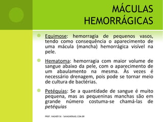 E QUIMOSE




PROF. VAGNER SÁ - SAVAGNER@IG.COM.BR
 