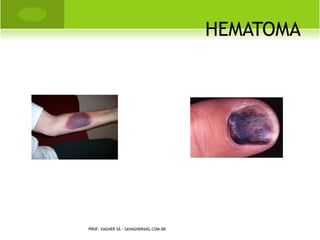 PETÉQUIAS




PROF. VAGNER SÁ - SAVAGNER@IG.COM.BR
 