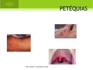 PROF. VAGNER SÁ - SAVAGNER@IG.COM.BR
 