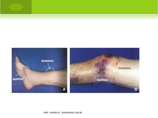 A NOMALIAS G ENERALIZADAS




PROF. VAGNER SÁ -
SAVAGNER@IG.COM.BR
 