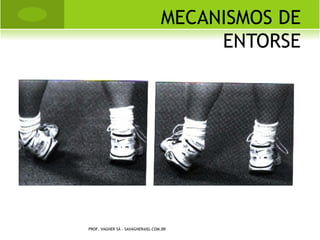 G ÊMEAS SIAMESAS




PROF. VAGNER SÁ - SAVAGNER@IG.COM.BR
 