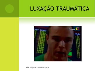 O STEOGÊNESE I MPERFEITA
Há cinco tipos de osteogênese imperfeita:

    Tipo I - mais comum, com herança autossômica dominante, caracterizada
por fragilidade óssea leve a moderada, osteoporose, esclerótica azul,
estatura normal e deficiência auditiva. É subdividida em tipo A, se a
dentinogênese é normal, e B, se imperfeita;
    Tipo II - mais grave e letal. Apresenta herança autossômica dominante,
esclera azul, face triangular, desproporção crânio-facial, membros curtos e
múltiplas fraturas;
    Tipo III - forma progressiva grave, autossômica dominante,
caracterizando-se por osteopenia, múltiplas fraturas com deformidade óssea
e na coluna. As escleras apresentam uma coloração azul-pálido na infância e
tornam-se normais posteriormente;
    Tipo IV - é raro, com herança autossômica, apresentando osteoporose,
fragilidade óssea e deformidade leve. A esclera tem coloração normal e o
comprometimento da audição é leve;
    Tipo V - semelhante ao tipo IV, diferenciando-se apenas por formação de
calos ósseos exuberantes e calcificações na membrana interóssea do
antebraço. .

             PROF. VAGNER SÁ - SAVAGNER@IG.COM.BR
 