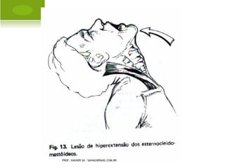 K LIPPEL -F EIL




PROF. VAGNER SÁ - SAVAGNER@IG.COM.BR
 