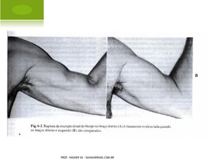 E SCOLIOSE




PROF. VAGNER SÁ - SAVAGNER@IG.COM.BR
 