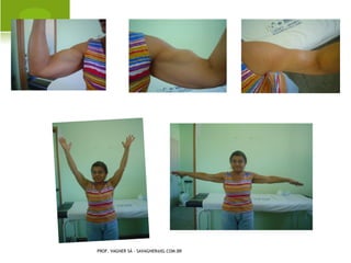 ESCOLIOSE




PROF. VAGNER SÁ - SAVAGNER@IG.COM.BR
 