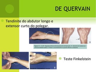 T ESTE A DAMS
                                         G IBOSIDADE




PROF. VAGNER SÁ - SAVAGNER@IG.COM.BR
 