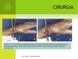 E SCOLIOSE I DIOPÁTICA




PROF. VAGNER SÁ - SAVAGNER@IG.COM.BR
 