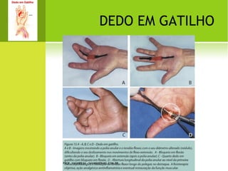 E SCOLIOSE A NTÁLGICA




PROF. VAGNER SÁ - SAVAGNER@IG.COM.BR
 