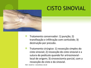 E SCOLIOSE                     POR   A SSIMETRIA




PROF. VAGNER SÁ - SAVAGNER@IG.COM.BR
 