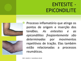 V ÉRTEBRAS
                               E RROS   DE F ORMAÇÃO




PROF. VAGNER SÁ - SAVAGNER@IG.COM.BR
 