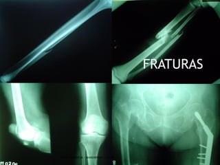 M ÉTODO DE COBB




PROF. VAGNER SÁ - SAVAGNER@IG.COM.BR
 